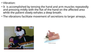 • Vibration:
• It is accomplished by tensing the hand and arm muscles repeatedly
and pressing mildly with the flat of the hand on the affected area
while the patient slowly exhales a deep breath.
• The vibrations facilitate movement of secretions to larger airways.
 