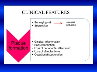 CLINICAL FEATURES
Plaque
formation
• Supragingival
• Subgingival
• Gingival inflammation
• Pocket formation
• Loss of periodontal attachment
• Loss of alveolar bone
• Occasional suppuration
Calculus
formation
 