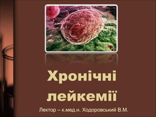 Хрон ічні лейкемії Лектор – к.мед.н. Ходоровський В.М. 