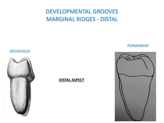 CHRONOLOGY AND MORPHOLOGY OF DECIDUOUS MANDIBULAR POSTERIORS.pptx