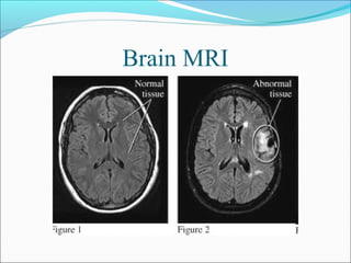 Brain MRI
 