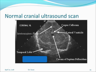 April 20, 2018 29Dr. Erem
 