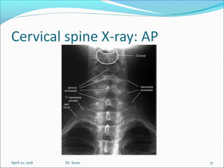 April 20, 2018 31Dr. Erem
 