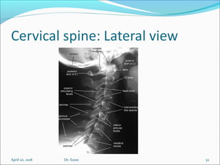 April 20, 2018 32Dr. Erem
 