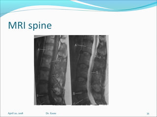 April 20, 2018 35Dr. Erem
 