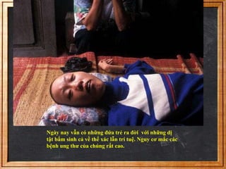 Ngày nay vẫn có những đứa trẻ ra đời với những dị 
tật bẩm sinh cả về thể xác lẫn trí tuệ. Nguy cơ mắc các 
bệnh ung thư của chúng rất cao. 
 