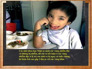 Các nhà khoa học Nhật so sánh các vùng nhiễm độc 
và không bị nhiễm, đã rút ra kết luận ở các vùng 
nhiễm độc tỉ lệ trẻ em sinh ra bị nguy cơ mắc chứng 
hở hàm ếch cao gấp 3 lần so với các vùng khác… 
 