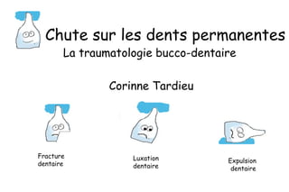 Chute sur les dents permanentes La traumatologie bucco-dentaire  Corinne Tardieu Fracture  dentaire Luxation  dentaire Expulsion  dentaire 