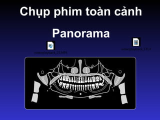 Chụp phim toàn cảnh
Panorama
videoplayback_3.FLV
videoplayback_23.MP4
 