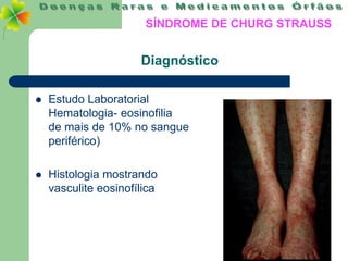 SÍNDROME DE CHURG STRAUSS


                      Diagnóstico

   Estudo Laboratorial
    Hematologia- eosinofilia
    de mais de 10% no sangue
    periférico)

   Histologia mostrando
    vasculite eosinofílica
 