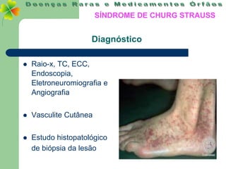 SÍNDROME DE CHURG STRAUSS


                     Diagnóstico

   Raio-x, TC, ECC,
    Endoscopia,
    Eletroneuromiografia e
    Angiografia


   Vasculite Cutânea


   Estudo histopatológico
    de biópsia da lesão
 