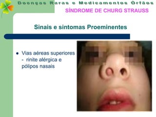 SÍNDROME DE CHURG STRAUSS


         Sinais e sintomas Proeminentes



   Vias aéreas superiores
    - rinite alérgica e
    pólipos nasais
 