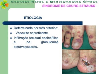 SÍNDROME DE CHURG STRAUSS


           ETIOLOGIA


   Determinada por três critérios:
    Vasculite necrotizante
   Infiltração tecidual eosinofílica
    e         de        granulomas
    extravasculares.
 