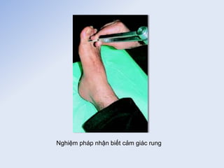 Nghiệm pháp nhận biết cảm giác rung
 