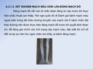 A.3.1.3. XÉT NGHIỆM MẠCH MÁU XÂM LẤN-ĐỘNG MẠCH ĐỒ
Động mạch đồ vẫn còn là chẩn đoán đáng tin cậy trước khi thực
hiện phẩu thuật can thiệp. Hội nghị quốc tế về Đánh giá bệnh mạch máu
ngoại biên trong đái tháo đường khuyến cáo mạnh mẽ ở bệnh nhân đái
tháo đường nên được thực hiện động mạch đồ trước khi quyết định đoạn
chi, để đáng giá chính xác tình trạng cây mạch máu, đặc biệt khi chỉ số
ABI và áp lực tâm thu ngón chân cho thấy có bệnh động mạch.
 