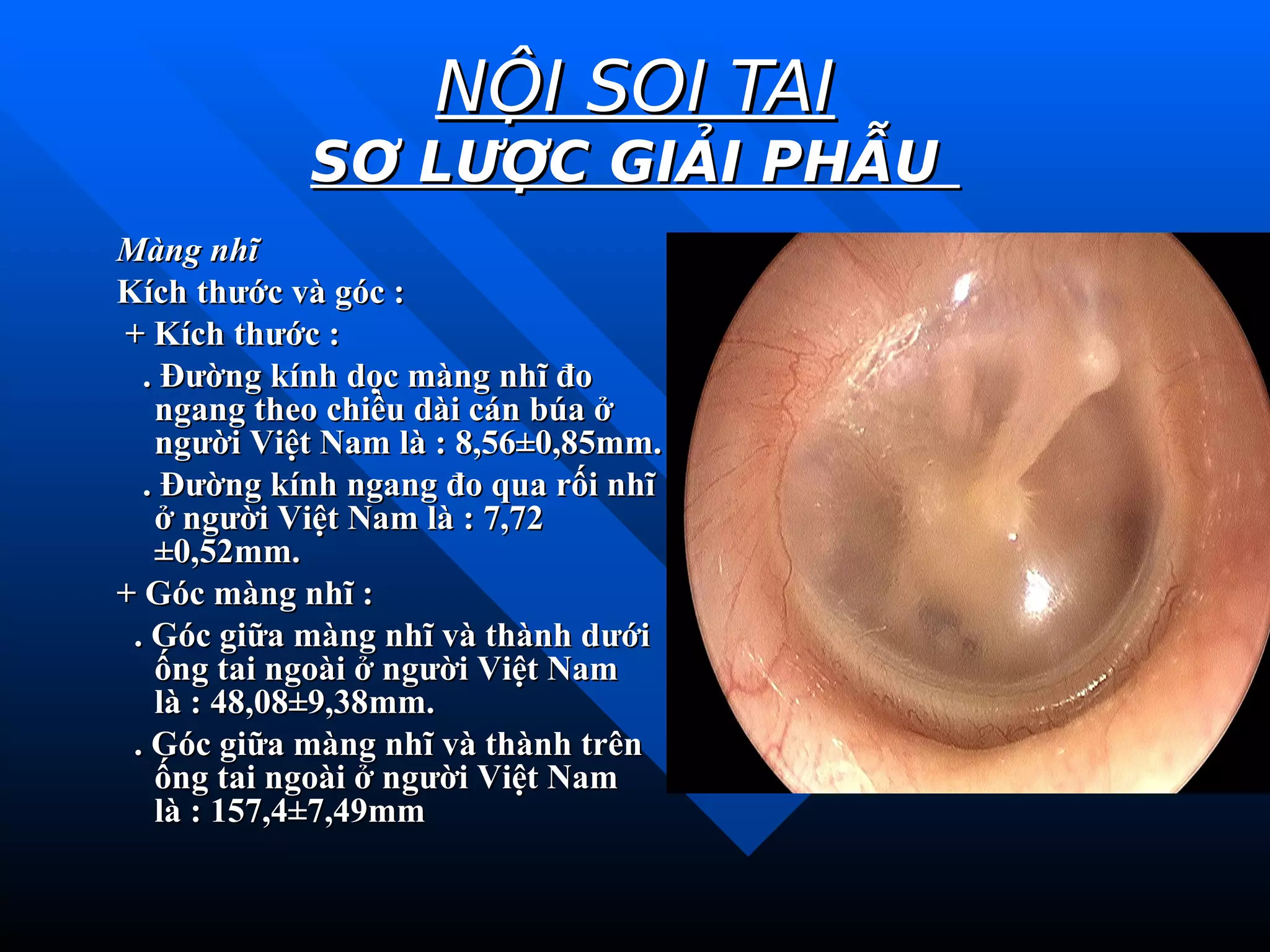 CHUYÊN ĐỀ NỘI SOI TAI.pdf