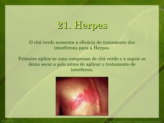 21. Herpes 08/24/10 Free Template from www.brainybetty.com O chá verde aumenta a eficácia do tratamento dos interferons para a Herpes. Primeiro aplica-se uma compressa de chá verde e a seguir se deixa secar a pele antes de aplicar o tratamento de interferon. 