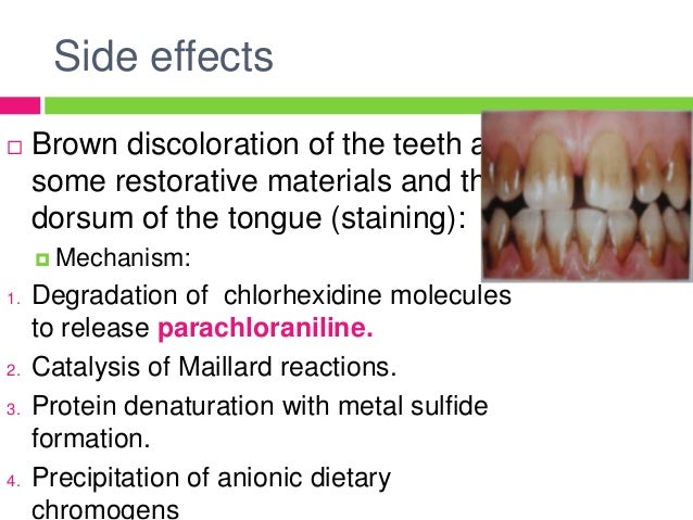 Chlorhexidine And Other Mouthwashes Chlorhexidine And Other Mouthwashes