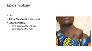 Epidemiology
• rare
• 1% to 2% of neck dissections
• Approximately
• 75% occur on the left side
• 25% occur on the right
 