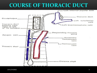 COURSE OF THORACIC DUCT
4CHYLOTHORAX
 