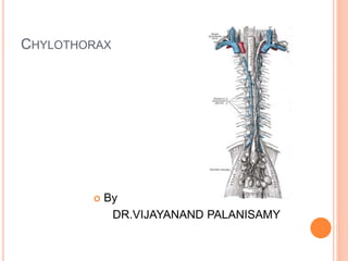 CHYLOTHORAX
 By
DR.VIJAYANAND PALANISAMY
 