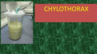 CHYLOTHORAX
 