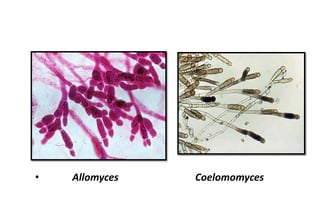CHYTRIDIOMYCOTA (Generalidades, características).pdf