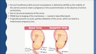 • Cervical	insufficiency	AKA	cervical	incompetence	is	defined	by	(ACOG)	as	the	inability	of	
the	uterine	cervix	to	retain	a	pregnancy	in	the	second	trimester,	in	the	absence	of	uterine	
contractions.
• Due	to	structural	weakness	of	the	cervix	
• PROM	due	to	bulging	of	the	membranes	—>	preterm	labor/fetal	death.
• It	typically	presents	as	acute,	painless	dilatation	of	the	cervix,	which	can	lead	to	a	
midtrimester	pregnancy	loss.
 