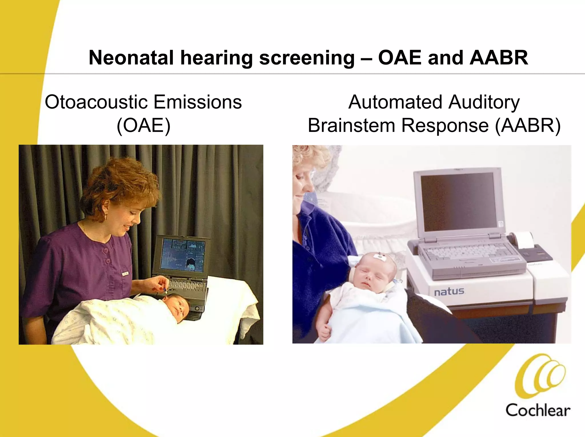 Neonatal hearing screening – OAE and AABR

Otoacoustic Emissions        Automated Auditory
       (OAE)            Brainstem Response (AABR)
 