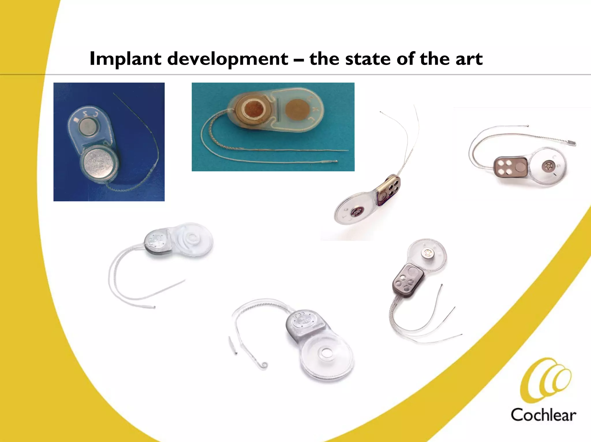 Implant development – the state of the art
 