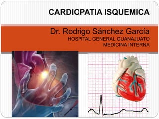 CARDIOPATIA ISQUEMICA
Dr. Rodrigo Sánchez García
HOSPITAL GENERAL GUANAJUATO
MEDICINA INTERNA
 