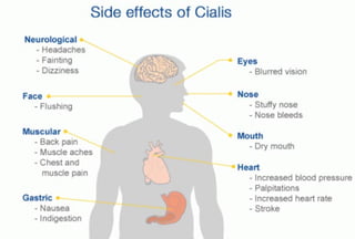 Side effects of Cialis