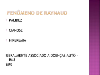  PALIDEZ
 CIANOSE
 HIPEREMIA
GERALMENTE ASSOCIADO A DOENÇAS AUTO –
IMU
NES
 