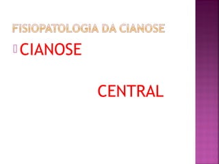  CIANOSE
CENTRAL
 