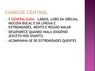  É GENERALIZADA – LÁBIOS, LOBO DA ORELHA,
MUCOSA BUCAL E DA LÍNGUA E
EXTREMIDADES, MENTO E REGIÃO MALAR
 DESAPARECE QUANDO INALA OXIGÊNIO
(EXCETO NOS SHUNTS)
 ACOMPANHA-SE DE EXTREMIDADES QUENTES
 