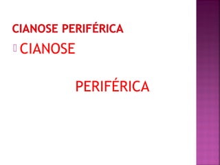  CIANOSE
PERIFÉRICA
 