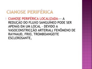  CIANOSE PERIFÉRICA LOCALIZADA--- A
REDUÇÃO DO FLUXO SANGUÍNEO PODE SER
APENAS EM UM LOCAL – DEVIDO A
VASOCONSTRICÇÃO ARTERIAL( FENÔMENO DE
RAYNAUD, FRIO, TROMBOANGEITE
ESCLEROSANTE,
 