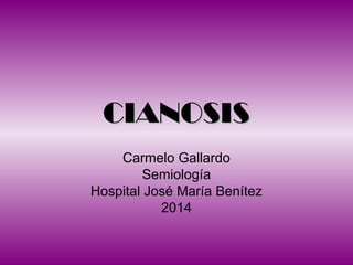 CIANOSISCIANOSIS
Carmelo Gallardo
Semiología
Hospital José María Benítez
2014
 