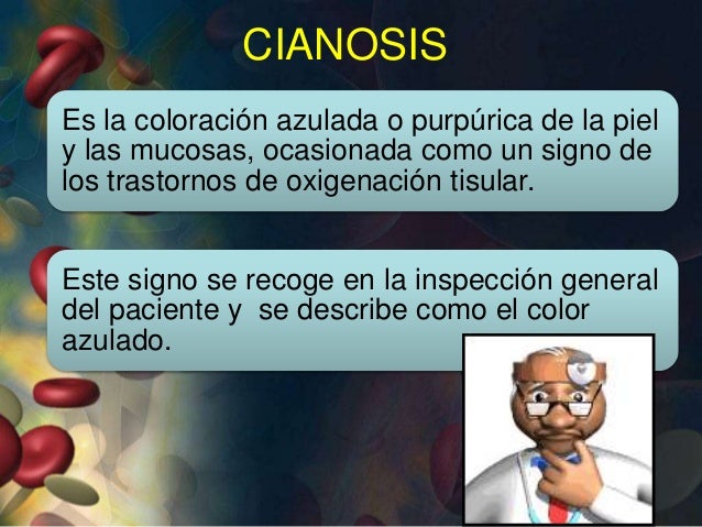 Cianosis Central y Periferica