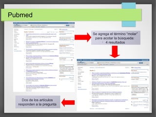 Pubmed
Se agrega el término “molar”
para acotar la búsqueda:

4 resultados
Dos de los artículos
responden a la pregunta
 