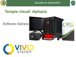 Escuela de Optometría
Terapia visual: diplopía
Software diplopia
 
