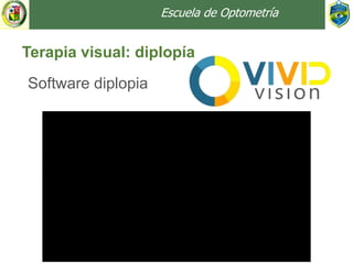 Escuela de Optometría
Terapia visual: diplopía
Software diplopia
 