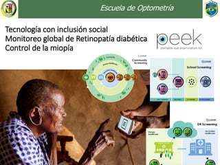 Tecnología con inclusión social
Monitoreo global de Retinopatía diabética
Control de la miopía
Escuela de Optometría
 