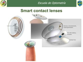 Escuela de Optometría
Smart contact lenses
 