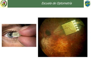 Escuela de Optometría
 