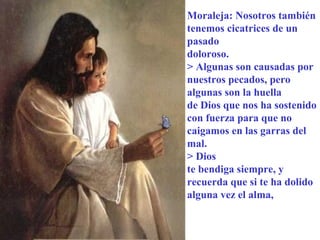 Moraleja: Nosotros también
tenemos cicatrices de un
pasado
doloroso.
> Algunas son causadas por
nuestros pecados, pero
algunas son la huella
de Dios que nos ha sostenido
con fuerza para que no
caigamos en las garras del
mal.
> Dios
te bendiga siempre, y
recuerda que si te ha dolido
alguna vez el alma,
 