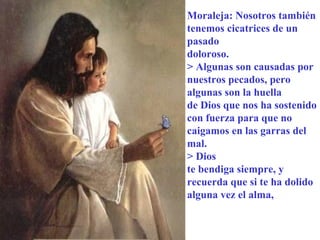 Moraleja: Nosotros también tenemos cicatrices de un pasado doloroso.  > Algunas son causadas por nuestros pecados, pero algunas son la huella  de Dios que nos ha sostenido con fuerza para que no caigamos en las garras del mal.  > Dios te bendiga siempre, y recuerda que si te ha dolido alguna vez el alma, 