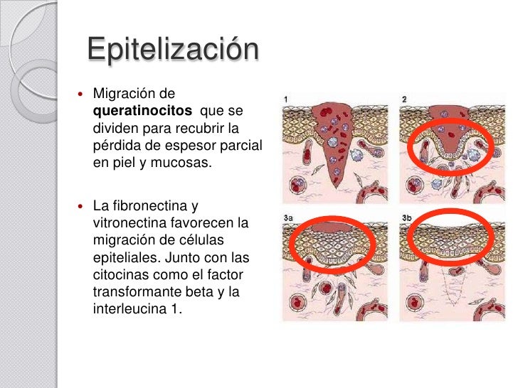 Histocicatrización