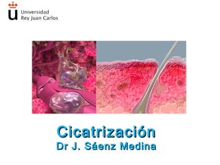 Cicatrización
Dr J. Sáenz Medina
 