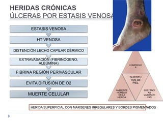 HERIDAS CRÓNICAS
ÚLCERAS POR ESTASIS VENOSA
HERIDA SUPERFICIAL CON MÁRGENES IRREGULARES Y BORDES PIGMENTADOS
COMPRESIÓ
N
AMBIENTE
HÚMEDO
DE LA
HERIDA
SUSTITU
TOS DE
PIEL
SUSTANCI
AS
VASOACTI
VAS
MUERTE CELULAR
EVITA DIFUSIÓN DE O2
FIBRINA REGIÓN PERIVASCULAR
EXTRAVASACIÓN (FIBRINÓGENO,
ALBÚMINA)
DISTENCIÓN LECHO CAPILAR DÉRMICO
HT VENOSA
ESTASIS VENOSA
 